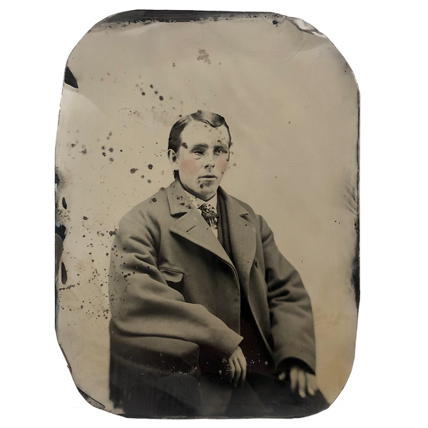 Man with Lost Eye, Pink Cheeks, Voluminous Coat, 19th C. Full Plate Tintype