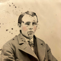 Man with Lost Eye, Pink Cheeks, Voluminous Coat, 19th C. Full Plate Tintype